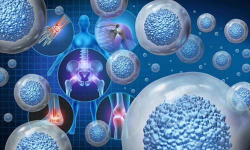 Alfa-2 Makroglobülin (A2M) Tedavisi Nedir? Nasıl Etki Eder?