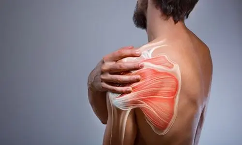Donuk Omuz Sendromu Nedir? Tanısı, Tedavisi ve Ameliyatı
