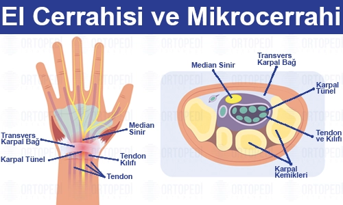 El Cerrahisi ve Mikrocerrahi Nedir? Nasıl Randevu Alınır?