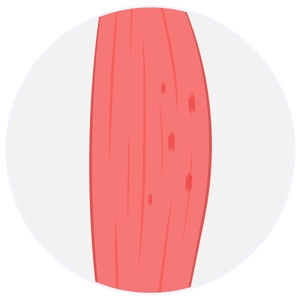 0. Derece (Muscular Strain) 0. Derece (Muscular Strain)