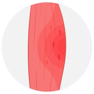 1. Derece Kas (Hafif) Yırtıkları 1. Derece Kas (Hafif) Yırtıkları