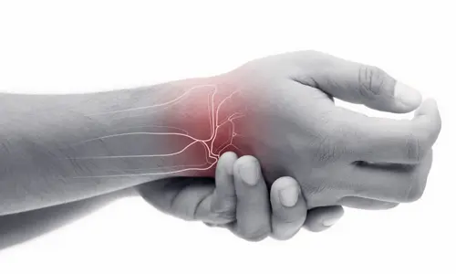 Kienböck Hastalığı Nedir? Belirtileri ve Tedavisi