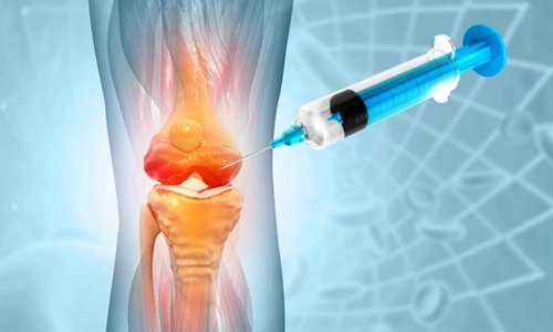 Kitosan Enjeksiyonu: Eklem Kalkanı İğnesi