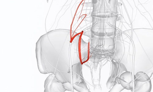 Kluneal Sinir Tuzaklanması Nedir? Tanısı ve Ameliyatı