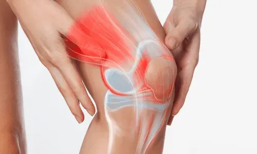 Kondromalaci patella on sale