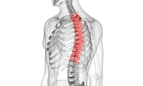 Osteoblastom Nedir? Belirtileri ve Tedavisi