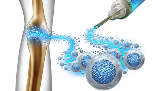 PRGF Tedavisi Nedir? Kimlere ve Nasıl Uygulanır?