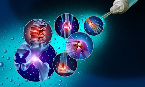 Sanakin Tedavisi Nedir? Kimlere ve Nasıl Uygulanır?