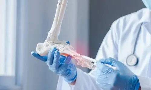 Ayak Bileği Kırığı Nedir? Belirtileri ve Tedavisi