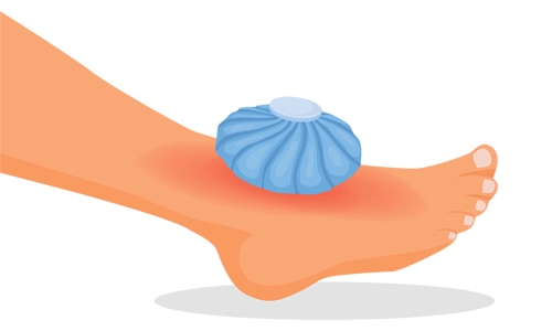 Ayak Şişmesi Nedir? Nedenleri ve Çeşitleri