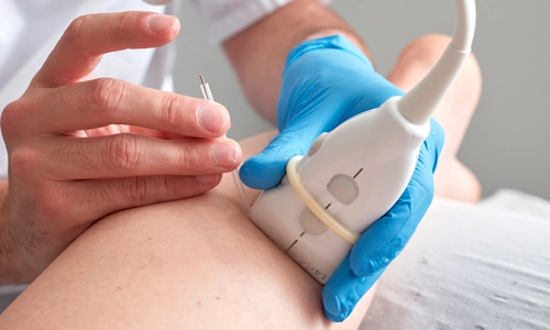 EPTE Tedavisi Nedir? Nasıl Uygulanır? Kaç Seans Gerekir?