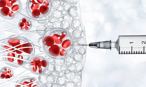 Glutatyon Nedir? Tedavisi ve Yan Etkileri