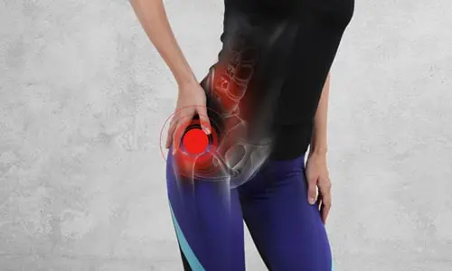 Kalça Ağrısı Neden Olur? Nasıl Geçer?