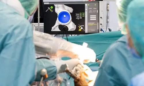 Hip Arthroscopy Surgery