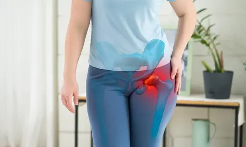 Kalça Sıkışma Sendromu Nedir? Tipleri? İyileşme Süresi?