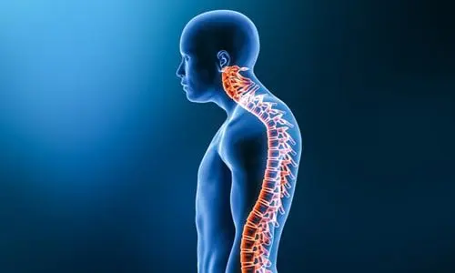 Kifoz Ameliyatı Nedir? Ameliyat Önce ve Sonrası