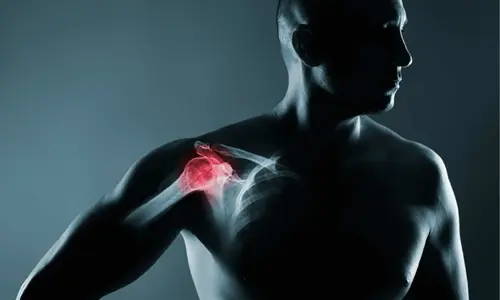 Omuz Kırığı Nedir? Tanısı ve Tedavisi
