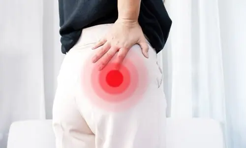 Piriformis Sendromu Nedir? Neden Olur?