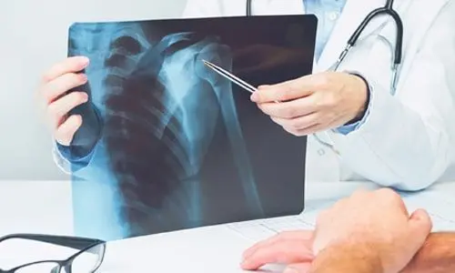 SLAP Lezyonu Nedir? Tanısı ve Tedavisi