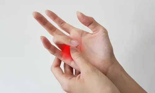 Tetik Parmak Sendromu Nedir? Tedavisi ve Ameliyatı