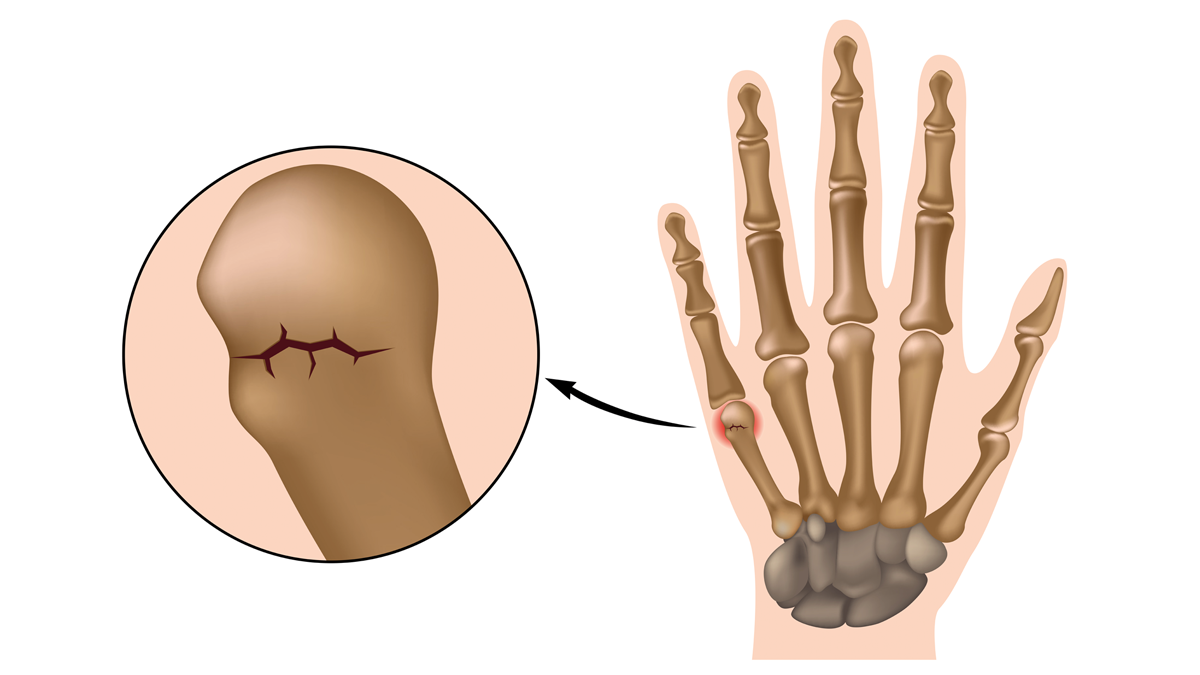 Ularning eshaklarini sikga ishqalash