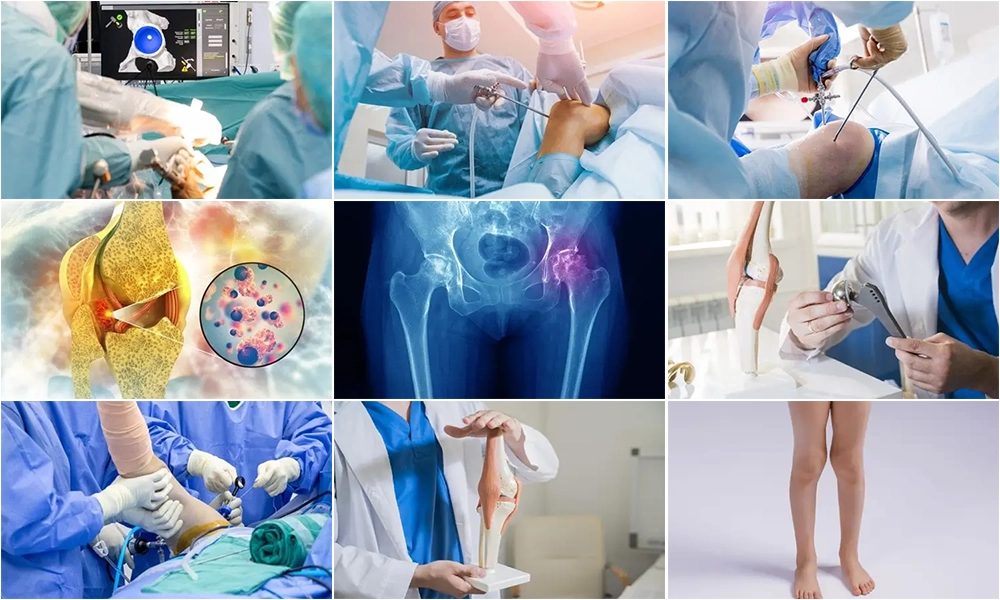 علاجات مركز إسطنبول لجراحة العظام